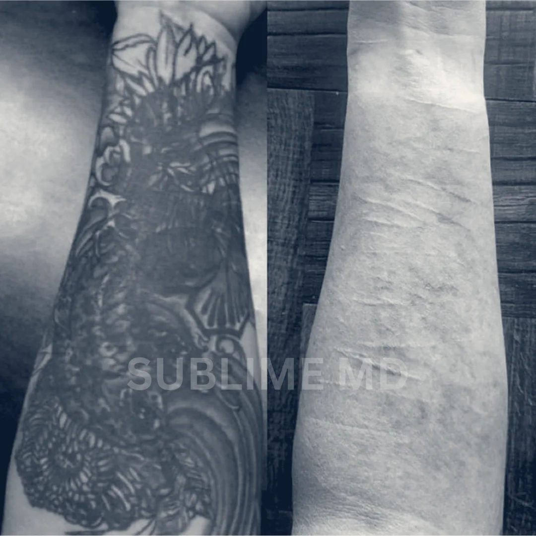 Sublime MD — Riverside, California