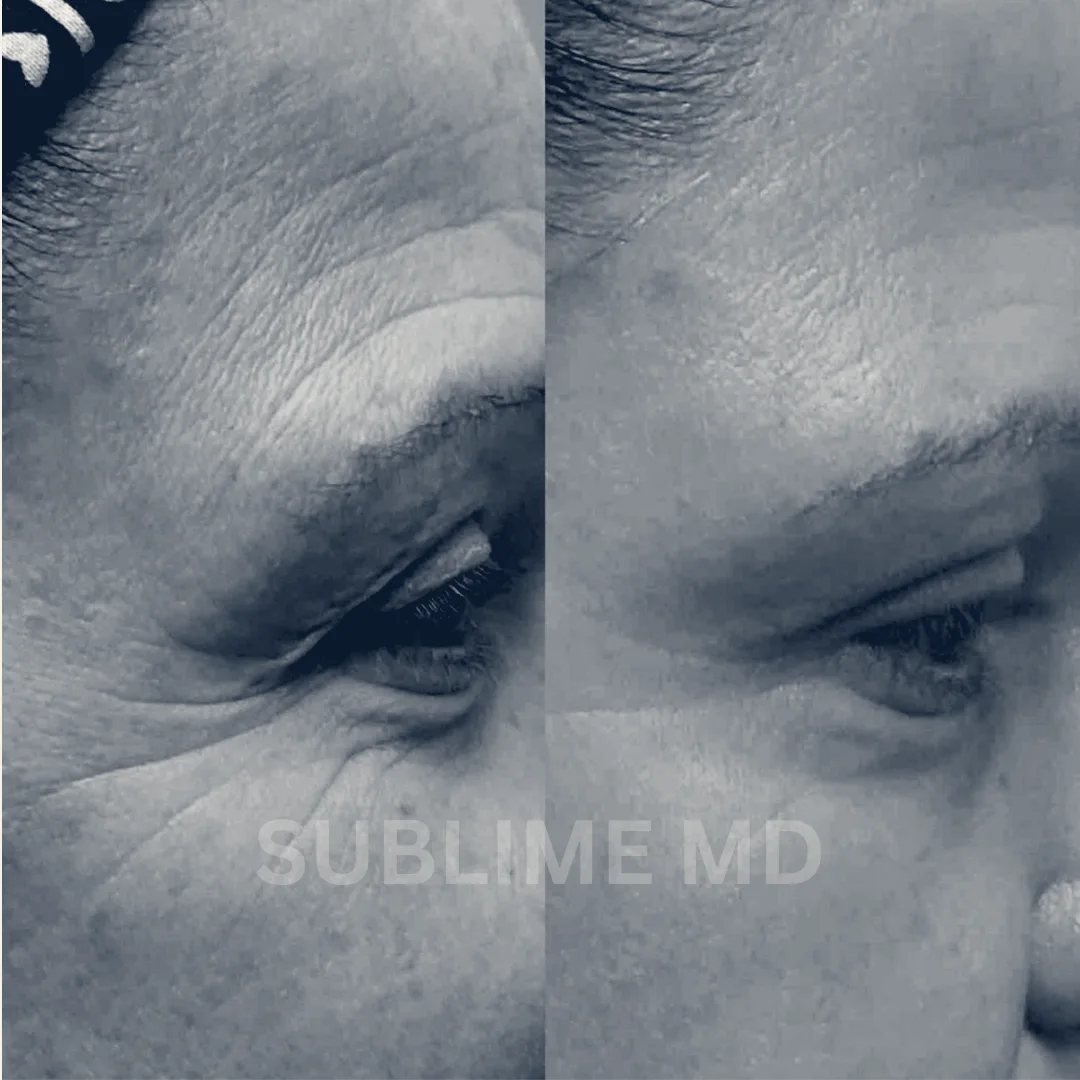 Sublime MD — Riverside, California