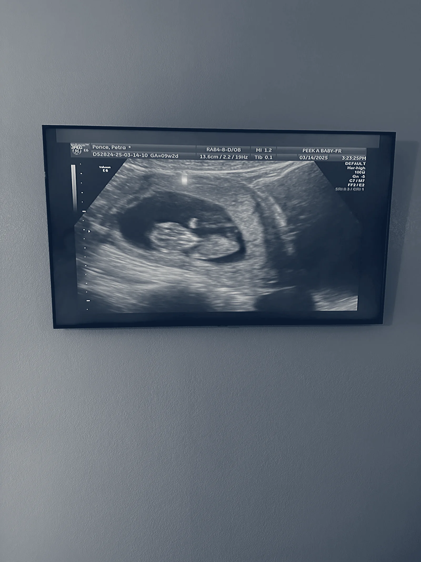 PEEK A BABY, Fresno, California