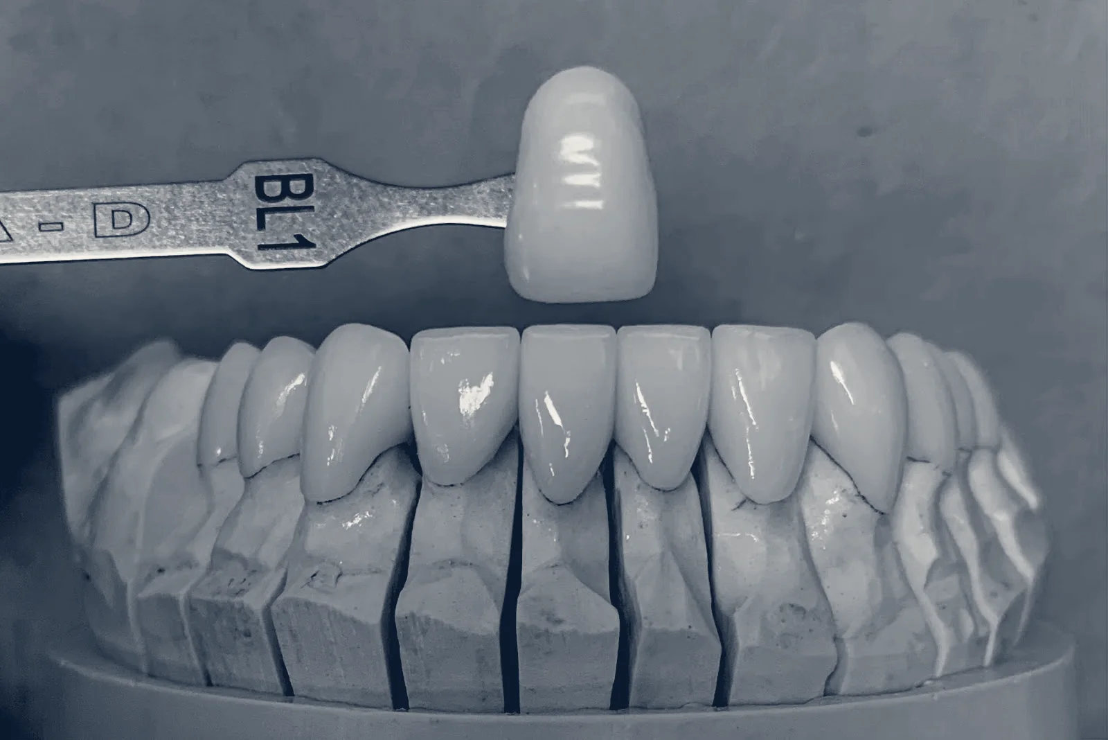 D. Dental, The Colony, Texas