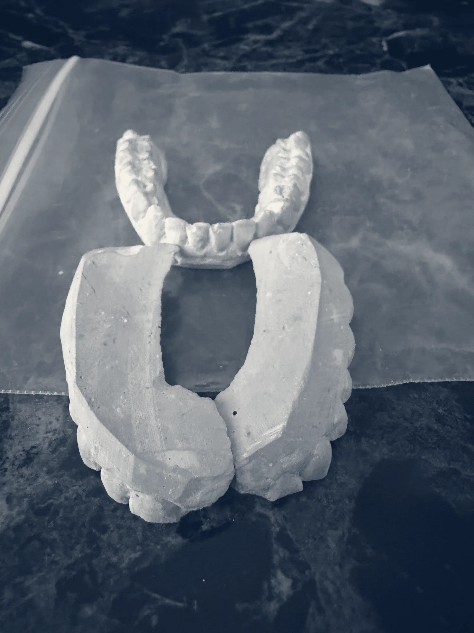 Hebron Smiles and Smilebliss Orthodontics, Carrollton, Texas