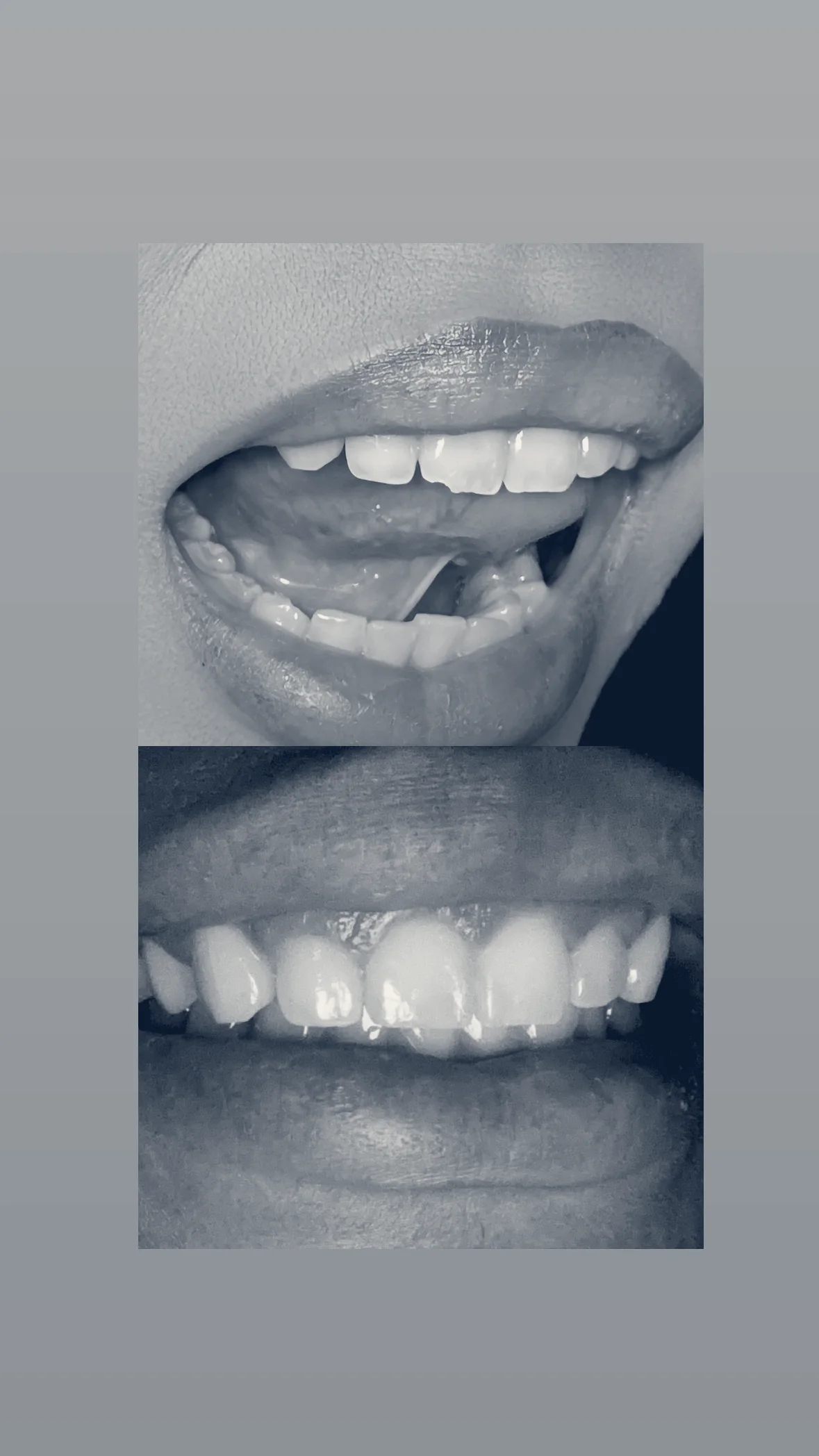 North Dallas Cosmetic Dentistry - Robert B. Mitchell, Dallas, Texas