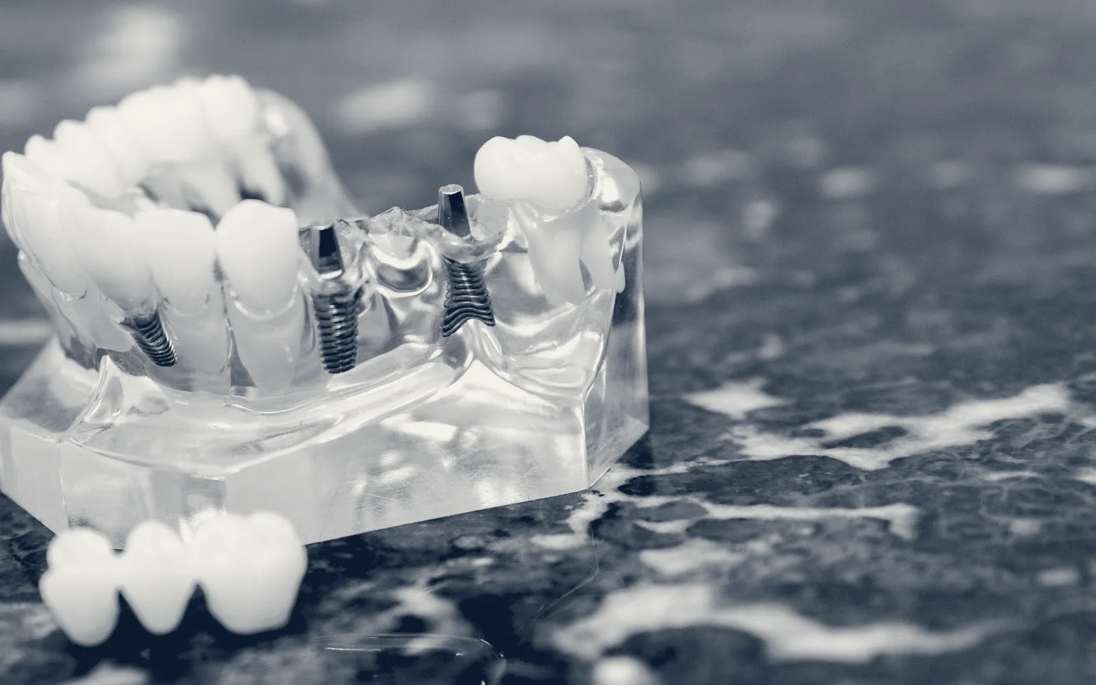 Texas Center for Oral Surgery & Dental Implants, Frisco, Texas