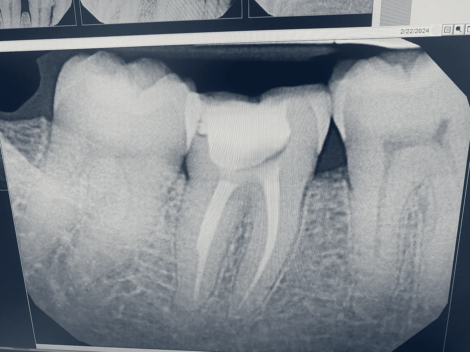 Texas Endodontic Center, Allen, Texas