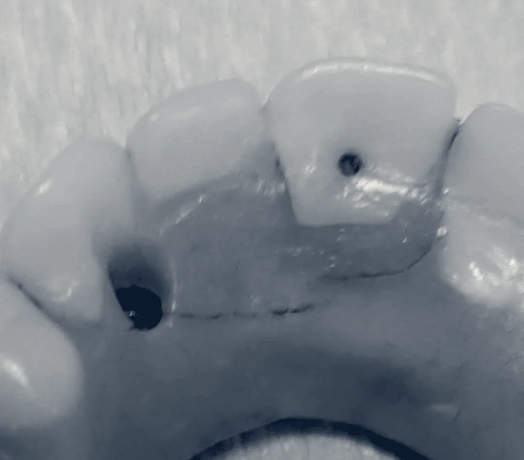 ClearChoice Dental Implant Center - Dallas, Dallas, Texas